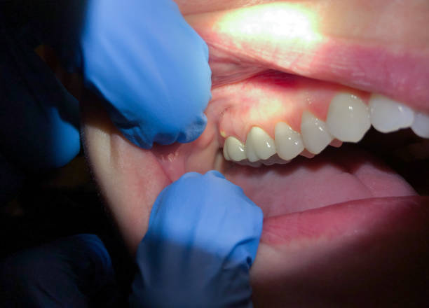Best Emergency Orthodontic Repairs in New Cordell, OK