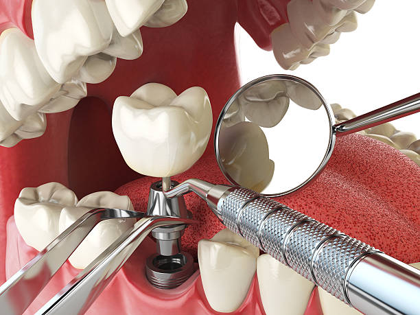 Reliable OK Emergency Dentist Solutions